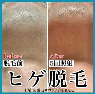 メンズ TSUBAKI上尾店所属・TSUBAKI上尾店 松下のエステ・リラクイメージ