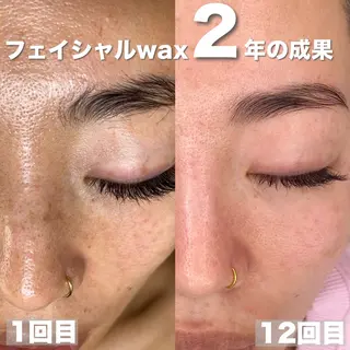 mone~total care salon~所属・mone (モーネ)のエステ・リラクイメージ