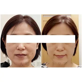小顔 美肌専門 Matoriaのエステ・リラクイメージ