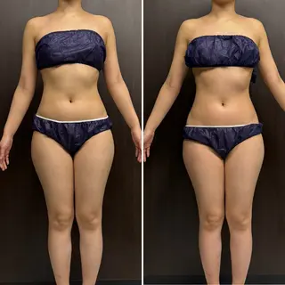 赤澤/本気痩せ・脱毛 ・ノーファンデ肌のエステ・リラクイメージ