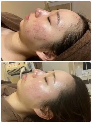 美u.p 鶴ヶ峰店のエステ・リラクイメージ