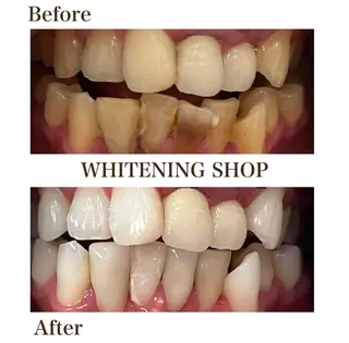 ホワイトニング ショップ伊丹店のその他イメージ