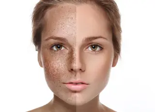 セミロング カラー パーマ ヘアアレンジ メンズ キッズ ネイル マツエク・マツパ Chloe-クロエ- 脱毛/フェイシャルのエステ・リラクイメージ