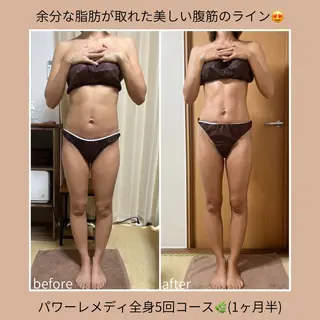 《本気痩せ×疲労改善 》  BILOOPのエステ・リラクイメージ
