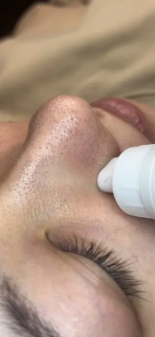 アイスリーサロン所属・毛穴改善サロン アイスリーのエステ・リラクイメージ