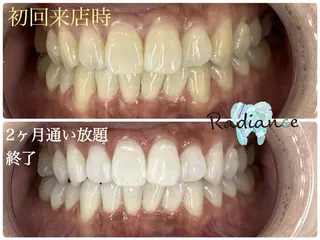 札幌ホワイトニング ラディアンス菊水店のその他イメージ