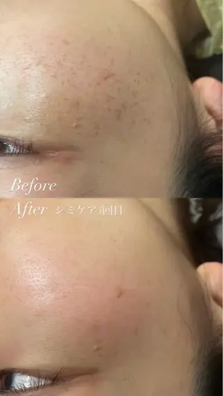 LUMIERE(ルミエル)福岡春吉店所属・LUMIERE 福岡のエステ・リラクイメージ