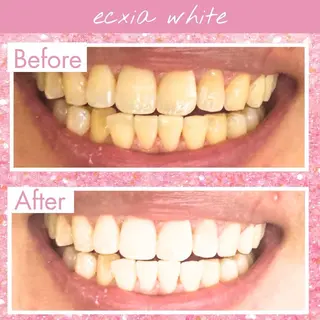 エクシア仙台駅東口店所属・セルフホワイトニング エクシア仙台駅東口店のその他イメージ