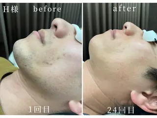 Hair Peace 脱毛サロンのエステ・リラクイメージ