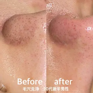 村松/ 小顔,ボディケアのエステ・リラクイメージ