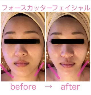 痩身/美肌/脱毛 MAX BEAUTYのエステ・リラクイメージ