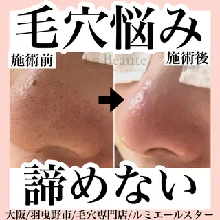 最速 毛穴シミ改善 いくえのその他イメージ