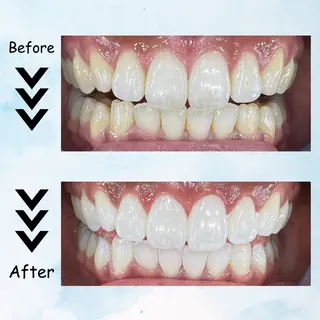 マツエク・マツパ セルフホワイトニング エクシア塩釜口駅前店のその他イメージ