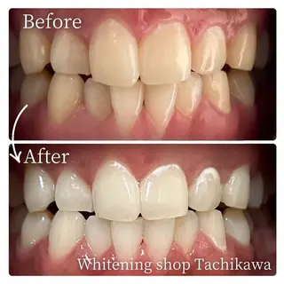 セルフ　ホワイト ニングショップ立川のその他イメージ