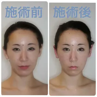 nano.face名古屋駅前店所属・美容鍼/小顔&整体 nano.faceのエステ・リラクイメージ