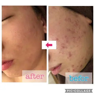 セミロング カラー パーマ ヘアアレンジ メンズ キッズ ネイル マツエク・マツパ 金の糸脱毛 産毛ケア専門のエステ・リラクイメージ