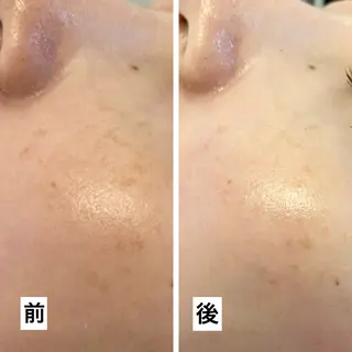 たるみ改善小顔エステ 堀葉月のその他イメージ