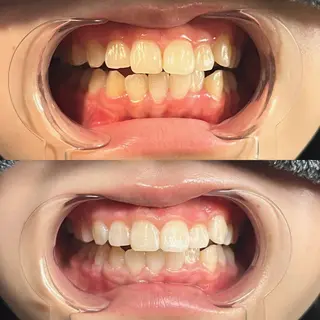 YuA beautyのその他イメージ