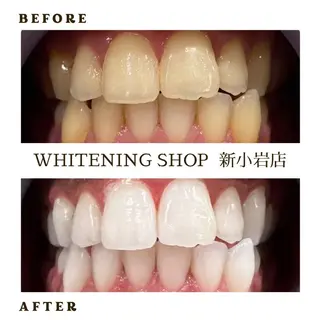 メンズ ホワイトニング ショップ新小岩店のその他イメージ