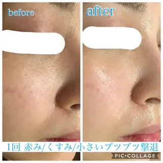 ロング カラー パーマ ヘアアレンジ キッズ ネイル マツエク・マツパ EnsorClair 代表 野口真央のエステ・リラクイメージ
