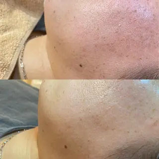 Meetite 小林のエステ・リラクイメージ