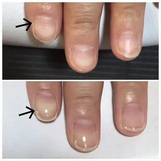 ネイル はたちや あみのマツエク・マツパデザイン