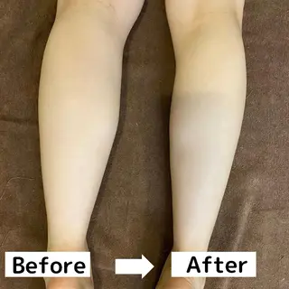 肩首こり×痩身×浄化 🌿リンパエステのエステ・リラクイメージ