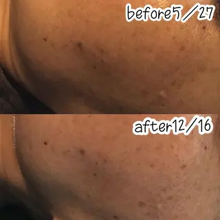 浜野 恵美のエステ・リラクイメージ