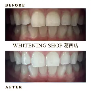 メンズ ホワイトニング ショップ葛西店のその他イメージ