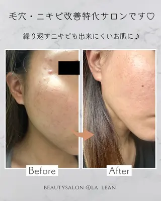 ~la lean~ ﾘｱﾝのエステ・リラクイメージ