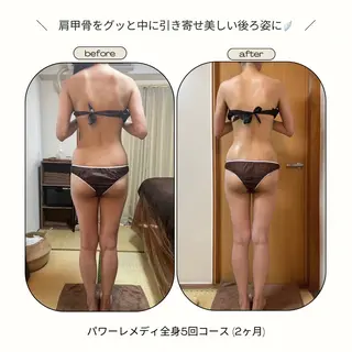 《本気痩せ×疲労改善 》  BILOOPのエステ・リラクイメージ