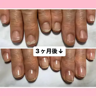 ネイル 自爪育成/深爪矯正 mikiのネイルデザイン