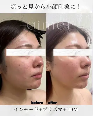 aimer 島田のエステ・リラクイメージ