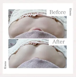 【バスト専門店 】 Kiana のエステ・リラクイメージ