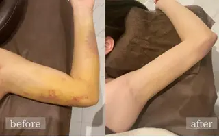 アプローズ所属・恵比寿/小顔/痩身 アプローズのエステ・リラクイメージ