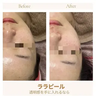看護師が施術する美容 ナスサロ/城野のエステ・リラクイメージ