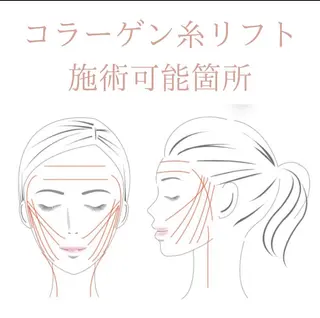 秒速小顔新宿南口 大谷のその他イメージ