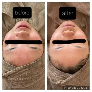 ECXIA ｴｸｼｱのエステ・リラクイメージ