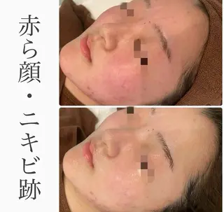 ハーブピーリング専門 BIOPLUS+川崎のエステ・リラクイメージ