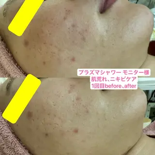 🎀エレガンテ🎀 美肌専門👸本間のその他イメージ