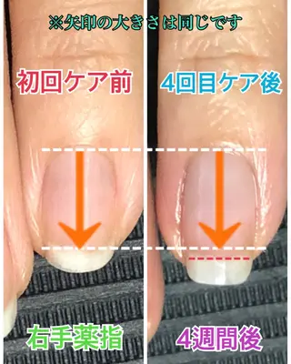 ネイル 自爪育成ネイルサロン Pause(ポーズ)のネイルデザイン