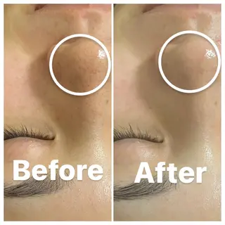 肌質改善・小顔サロン 20代店長RINNAのエステ・リラクイメージ