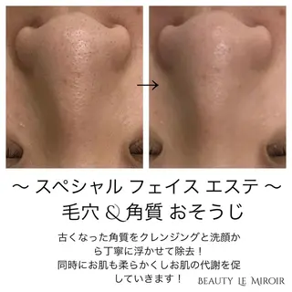 マツエク・マツパ ビューティー ミロワールのエステ・リラクイメージ