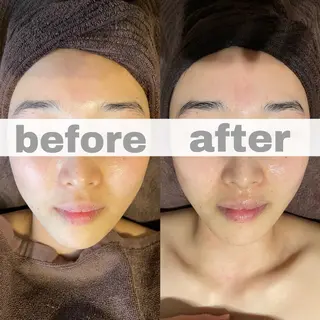 uru.所属・林田 圭純のエステ・リラクイメージ