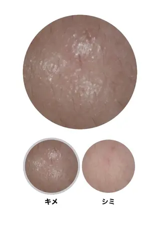 メナード天王寺駅東口 稲冨恵美のエステ・リラクイメージ