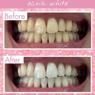 𝒀𝑼𝑰 店長⋆𝜗𝜚のその他イメージ