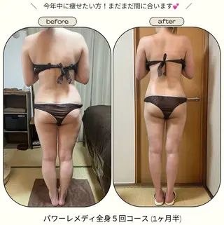 《本気痩せ×疲労改善 》  BILOOPのエステ・リラクイメージ