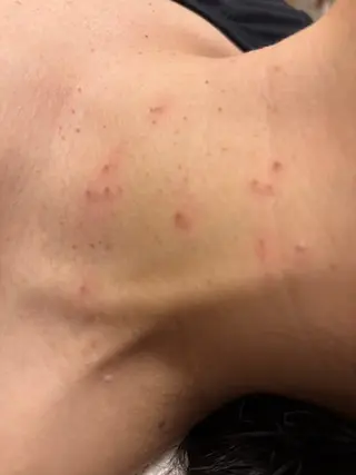 大阪大東市 / 体質・肌質改善サロン アンシャンテ所属・体質・肌質改善サロン アンシャンテのエステ・リラクイメージ