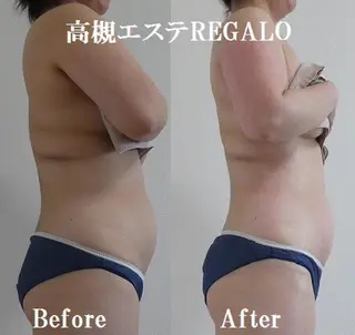 REGALO所属・矢野 さやかのエステ・リラクイメージ