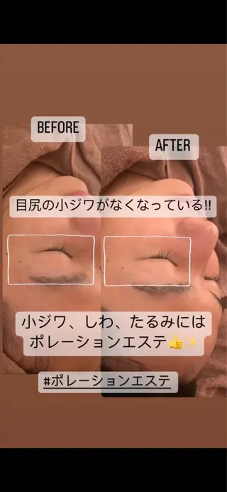 I. Ayaのエステ・リラクイメージ